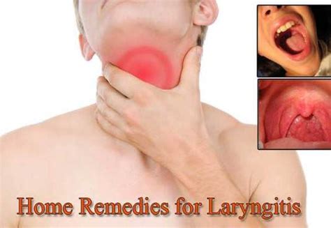 Home Remedies to Get Rid of Laryngitis