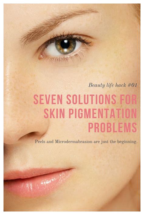 Skin pigmentation problems are common and luckily there are easy ...