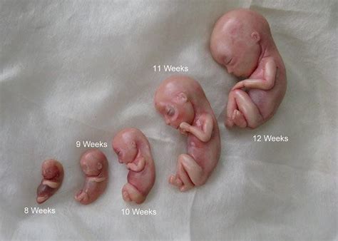 Abortion Cost At 12 Weeks - Doctor Heck