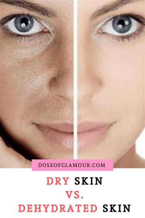 Dry vs. dehydrated skin. Dehydrated skin is a skin condition that lacks sufficient wate ...