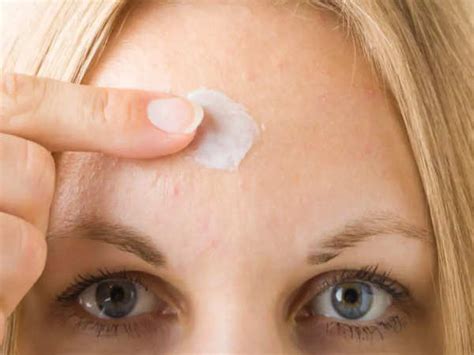 Suffering from forehead pimples? These may be the causes - Times of India