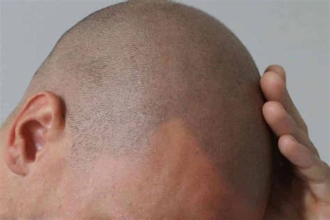 Bestof You: Top Bald Head Hairline Tattoo In 2023 Don'T Miss Out!