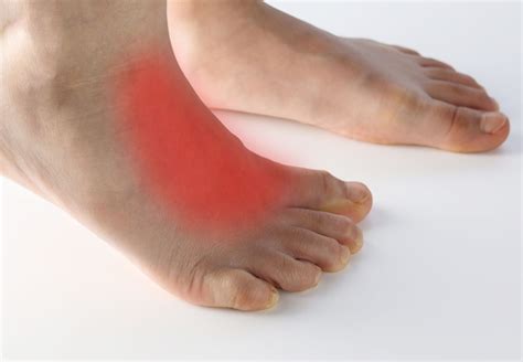 Tendonitis On Top Of Foot Pain Relief Top Sellers | emergencydentistry.com