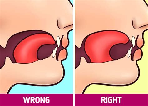 Proper Mewing Tongue Posture: Before and After Adopting Correct Resting ...