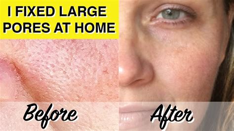 At Home Glycolic Acid Peel THAT WORKS! Over 40 Skincare, 58% OFF