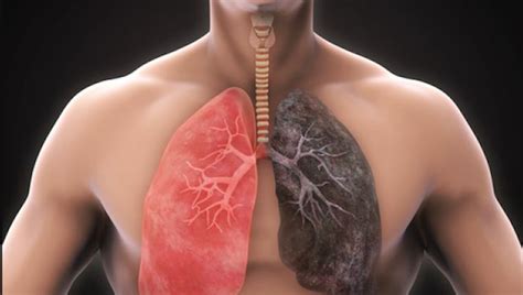 Ayurveda Treatment for Lung Disease - Permanent Cure