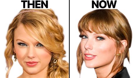 Taylor Swift NEW FACE | Plastic Surgery Analysis :: GentNews