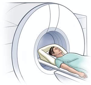 Optic Neuritis | Johns Hopkins Medicine