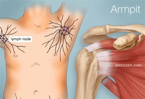 Lymph nodes | Treat skin, Armpits, Armpit lump