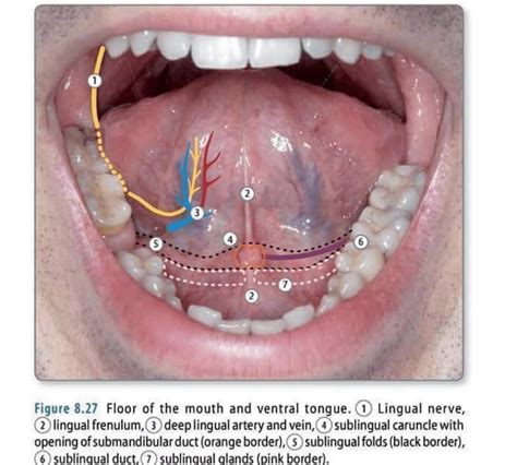 Sublingual Caruncle | News | Dentagama