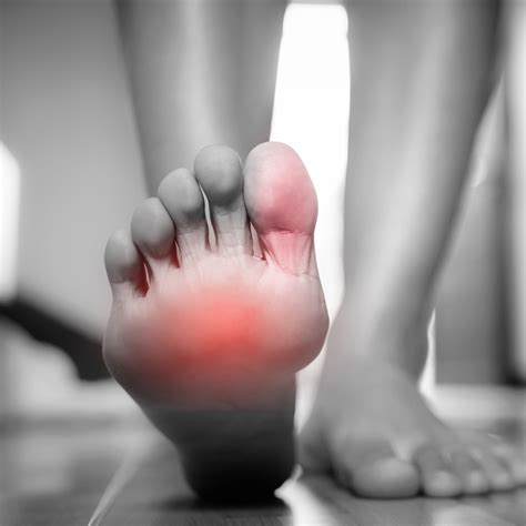 Claw toes, foot pain? - Check out West Suburban Pain Relief!