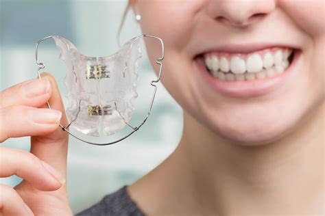 Plastic Vs. Metal Retainers | TX Orthodontic Services