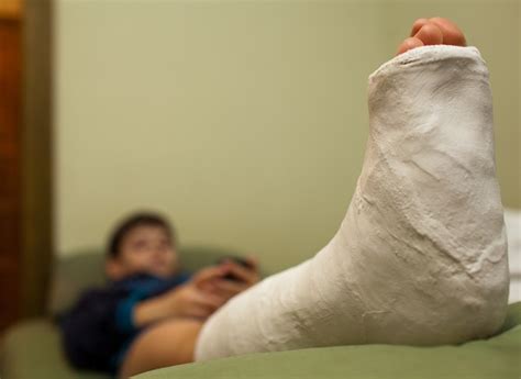 Overview of Pediatric Fractures - Orthopaedic Specialists