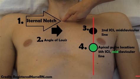 Apical Pulse Assessment and Location