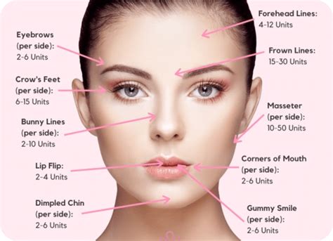 How many units of Botox will I need? - Skinjectables