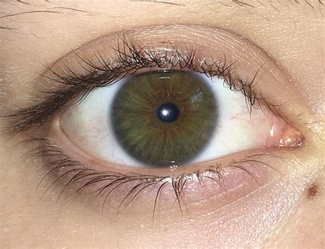 hazel or central heterochromia? : r/eyes