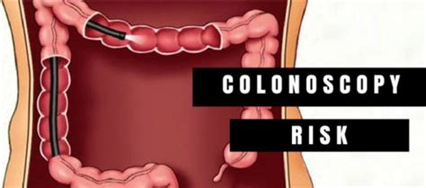 Colonoscopy: The Risks And Preparing For The Procedure