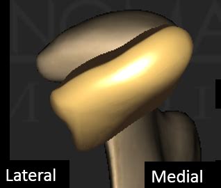 How To Diagnose Clicking Jaw Joints - Spear Education