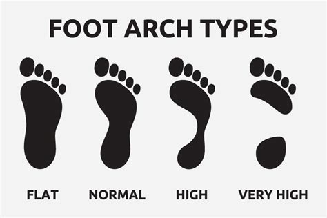 Recurring foot arch pain? Here are some possible reasons | Sanders Podiatry