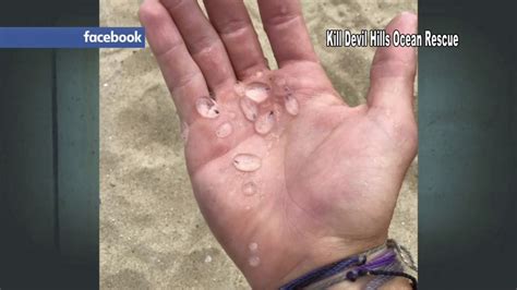 What are those blobs washing ashore on the Outer Banks? Hint: They're not jellyfish - ABC11 ...