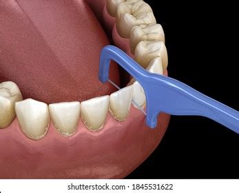 Oral Hygiene Using Toothpick Dental Floss Stock Illustration 1646434024 | Shutterstock