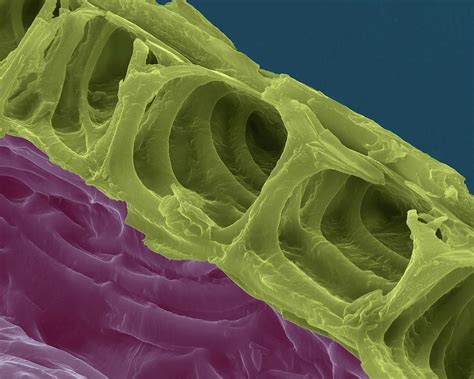 Plant Cell Wall Microscope Image - Micropedia