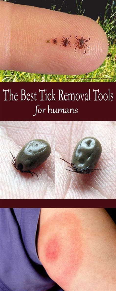 How To Remove A Tick From Dog - HOWTORMEOV