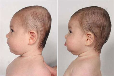 Da Baby Head Shape - The Ins And Outs Of Flat Head Syndrome In Babies ...