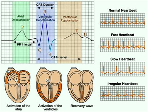 Electrocardiogram Test (ECG) : Procedure,Types and Medical Uses