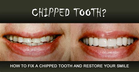 Chipped Tooth Repair Molar