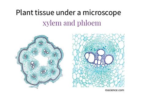 Xylem And Phloem Under Microscope