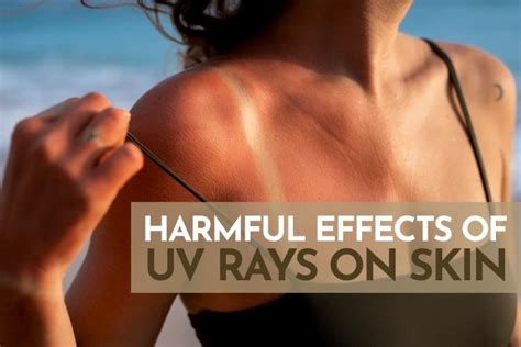 4 Harmful Effects of UV Rays on Skin — Skin MD - Dermatologist in Ortigas, Pasig