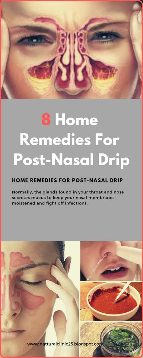 8 Home Remedies For Post-Nasal Drip | Remedies, Herbal medicine, Home ...