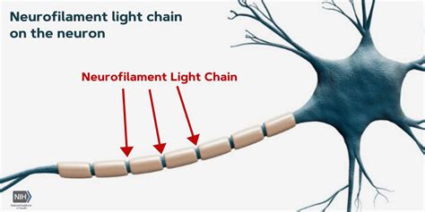 Blood-based biomarker can detect, predict severity of traumatic brain injury | National ...