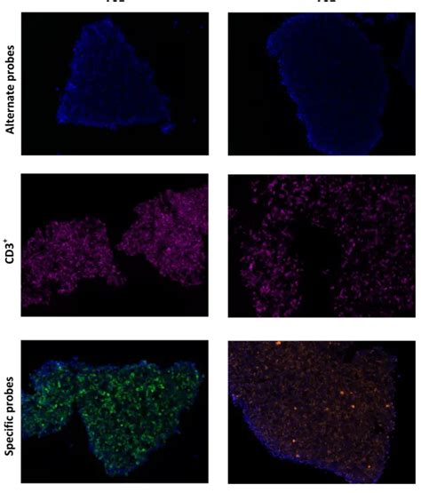 RNAscope protocol - Development of ISH protocol for Vδ1/ Vδ2/ Vδ3 visualisation