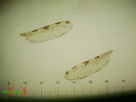 SOP: Dissection and measurement of mosquito wings