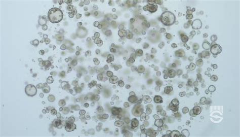 Culturing Intestinal Cancer-Derived Organoids