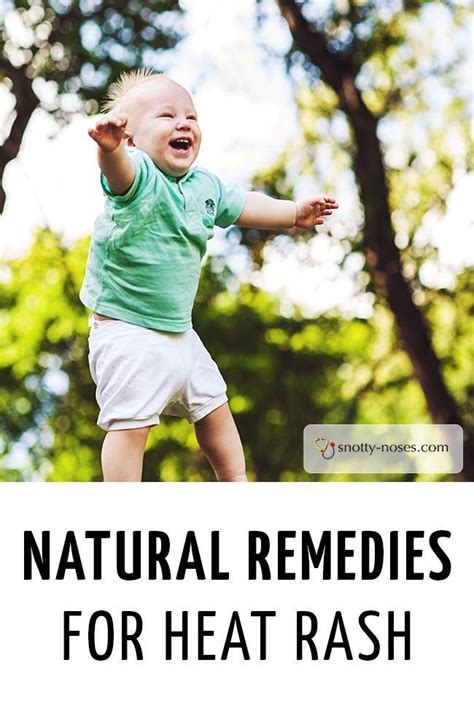 Natural Remedies for Heat Rash in Children | Heat rash, Heat rash remedy, Rashes in children