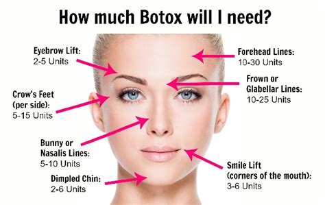 Botox Side Effects Forehead