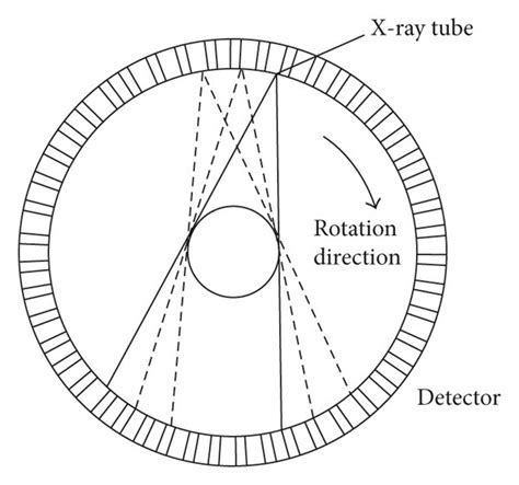 A schematic diagram of CT scanner process and the sketch of its working ...