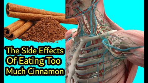 The Side Effects Of Eating Too Much Cinnamon - What Happens If You Eat Too Much CINNAMON - YouTube