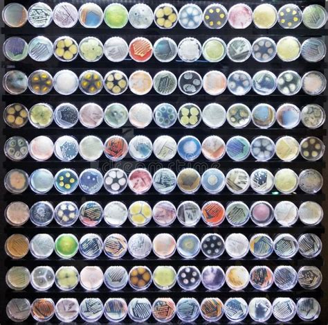 Agar Plates Containing Many Types of Bacterial Colonies Stock Photo - Image of medium, streak ...