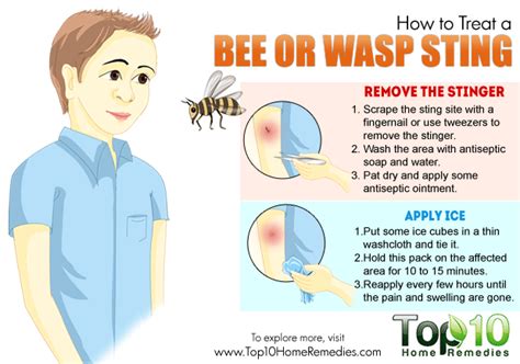 How to Treat a Bee or Wasp Sting - eMediHealth | Wasp stings, Remedies ...