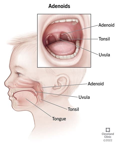 Adenoid Nose