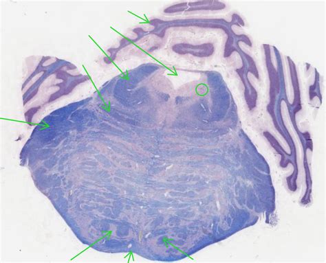 Diagram of Upper Rostral Pons Histology 4 | Quizlet