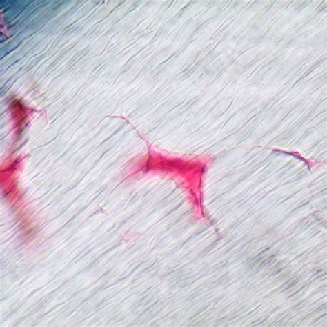 S-shaped dentinal tubules were well observed on crown from peripheral... | Download Scientific ...