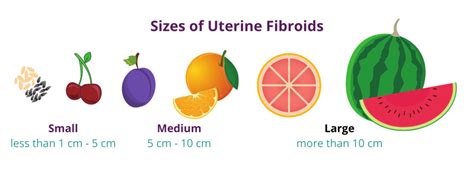 Uterus Fibroid Size Chart In Mm - Best Picture Of Chart Anyimage.Org