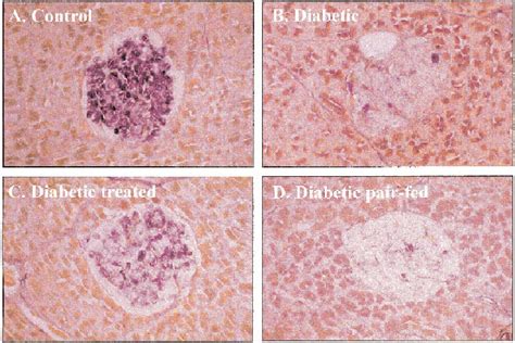 Islet histology. Photomicrographs of islets stained for beta-cells in ...