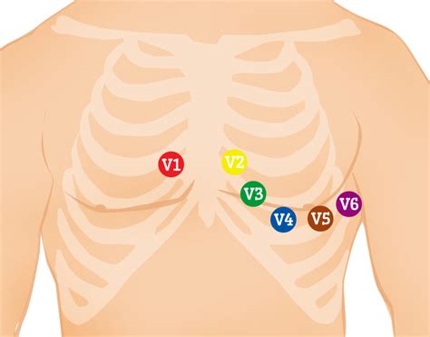 12-Lead ECG Placement: The Ultimate Guide