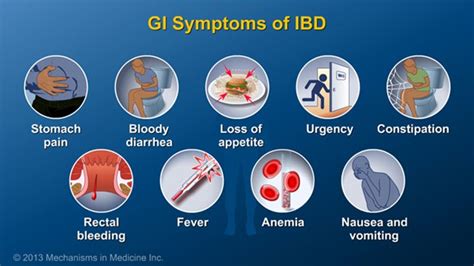 Pin on Understanding IBD